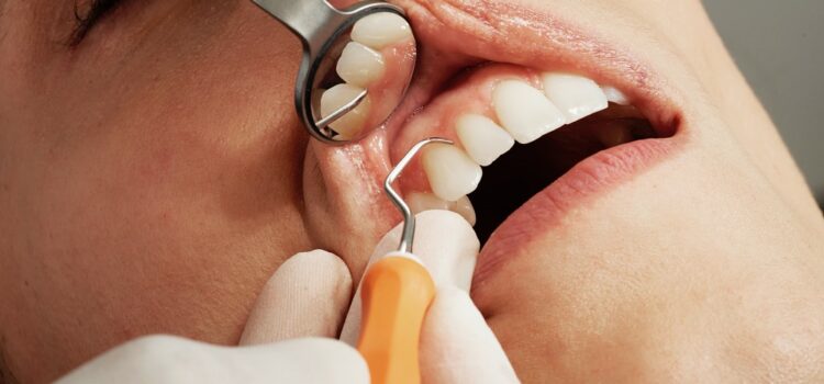 Cum tratăm durerea de dinți?