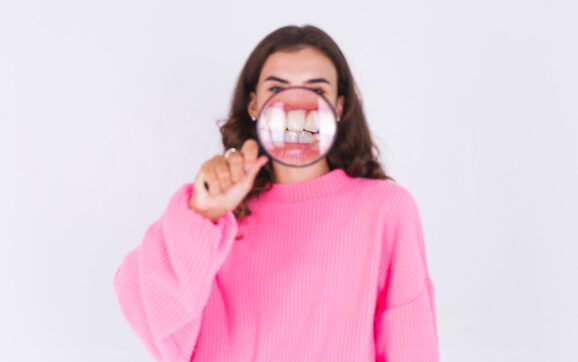Semnele care indică că ai nevoie de un aparat dentar