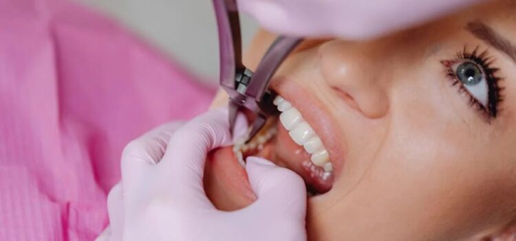 Tipuri de extracții dentare: care sunt și când se recomandă?